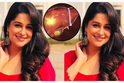 Dipika Kakar liver tumor