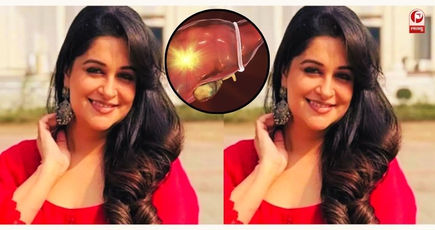 Dipika Kakar liver tumor