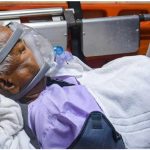 Lalu Prasad Yadav Health Update